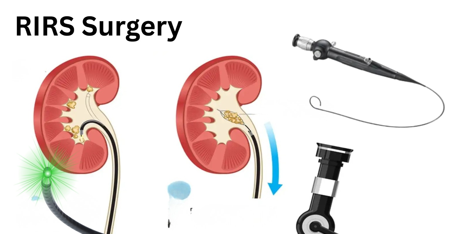 NKPC Advanced Urology